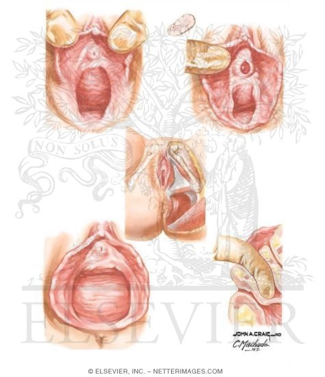 Watermarked preview of unlabeled image: Inspection of Vulva