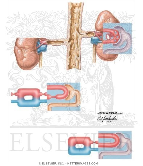 Ischemic Nephropathy