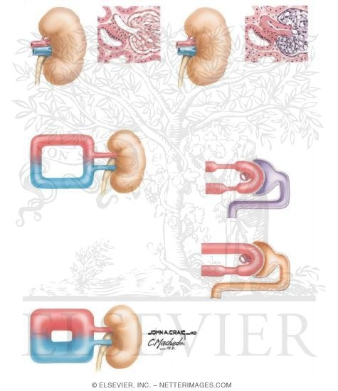 Watermarked preview of unlabeled image: Nephron Heterogeneity Theory