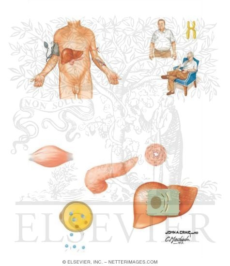 Watermarked preview of unlabeled image: Metabolic Syndrome