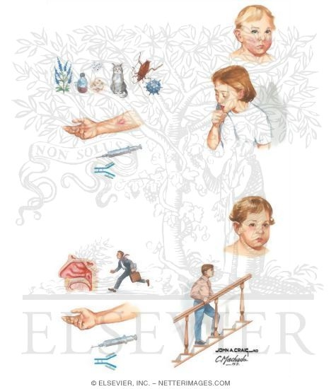 Asthma Classification