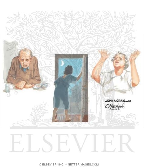 Watermarked preview of unlabeled image: Pharmacologic Management Options In Alzheimer's Disease