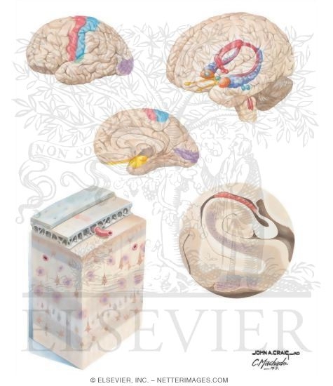 Distribution of Pathology in Alzheimer's Disease