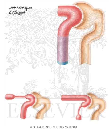 Watermarked preview of unlabeled image: Glomerular Filtration and Peritubular Reabsorption