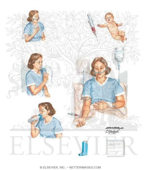 Watermarked preview of unlabeled image: Hospital Management in Asthma