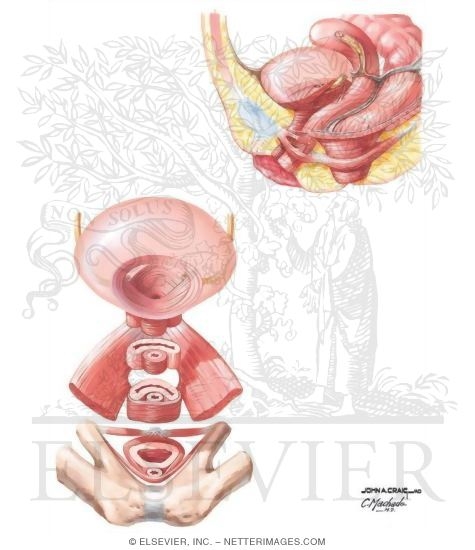 Watermarked preview of unlabeled image: Internal and External Sphincters