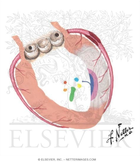 Watermarked preview of unlabeled image: Inadequate Coronary Flow
