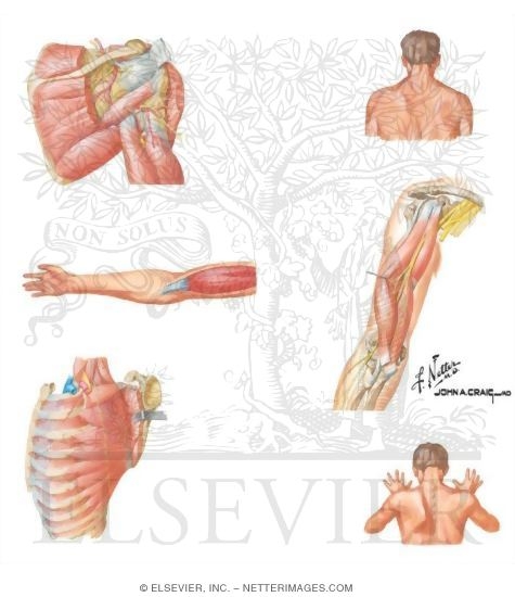 Watermarked preview of unlabeled image: Neuropathy About Shoulder