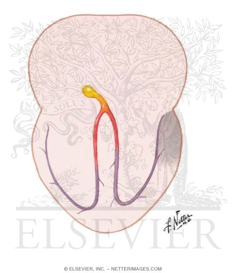 Watermarked preview of unlabeled image: Pre-excitation Syndrome