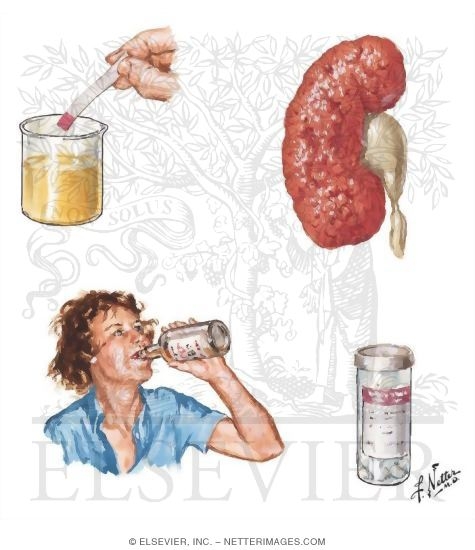 Watermarked preview of unlabeled image: Peripheral Neuropathies: Metabolic, Toxic and Nutritional