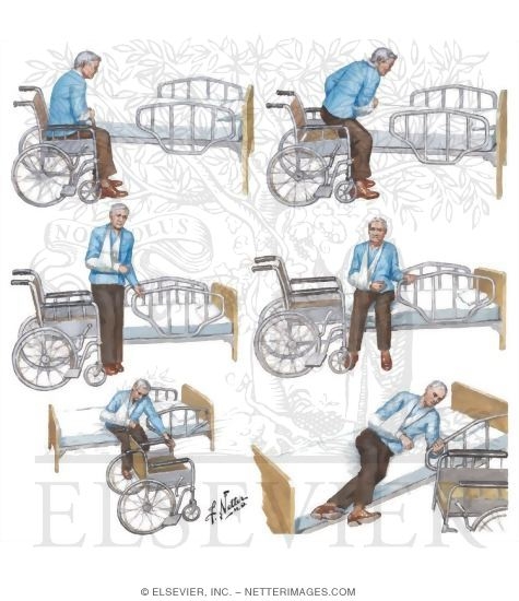 Transfer From Wheelchair To Bed After Stroke transfer-from-wheelchair-to-bed-after-stroke
