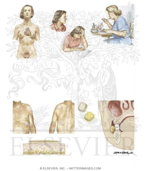 Watermarked preview of unlabeled image: Nicotine Withdrawal