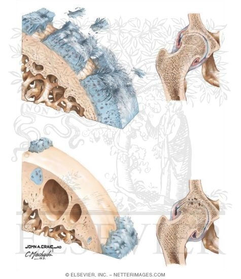 Joint and Articular Changes