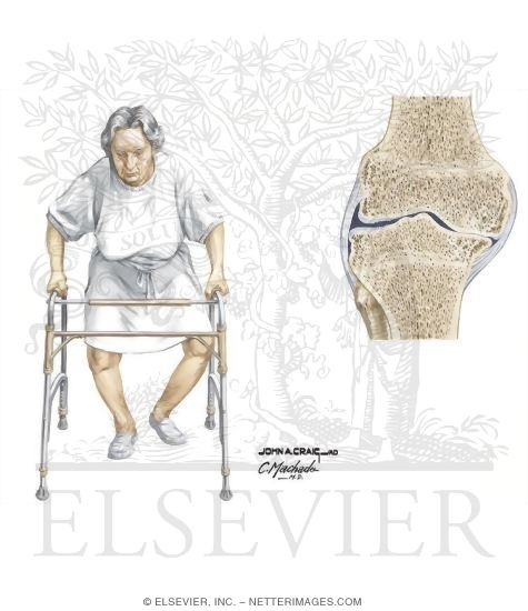 Watermarked preview of unlabeled image: Knee