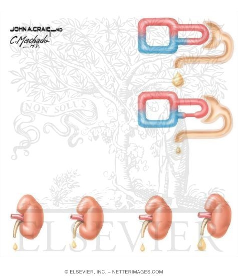 Watermarked preview of unlabeled image: Renal Mechanisms in Blood Pressure Control