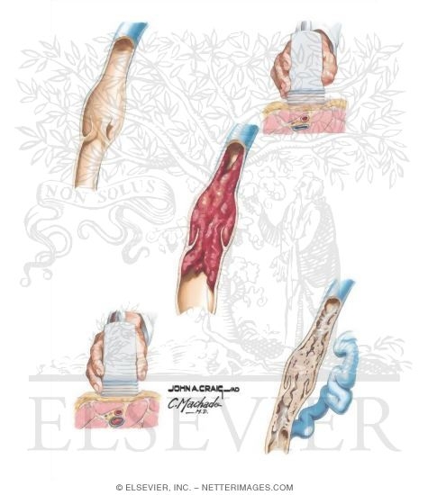 Watermarked preview of unlabeled image: Noninvasive Venous Imaging