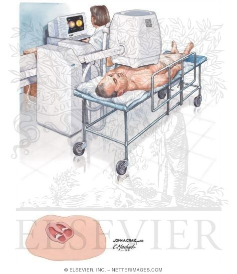 Watermarked preview of unlabeled image: Planar Nuclear Scan