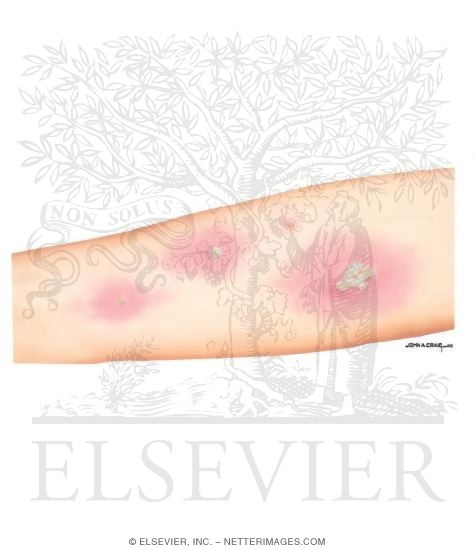 Watermarked preview of unlabeled image: Adjunctive Diagnostic Testing in Asthma