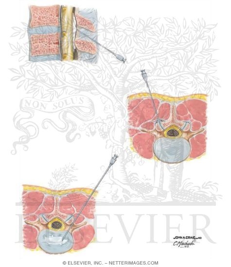Watermarked preview of unlabeled image: Injection Techniques