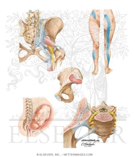 Watermarked preview of unlabeled image: Sacroiliac Joint Pain