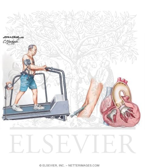 Watermarked preview of unlabeled image: Exercise Stress Testing