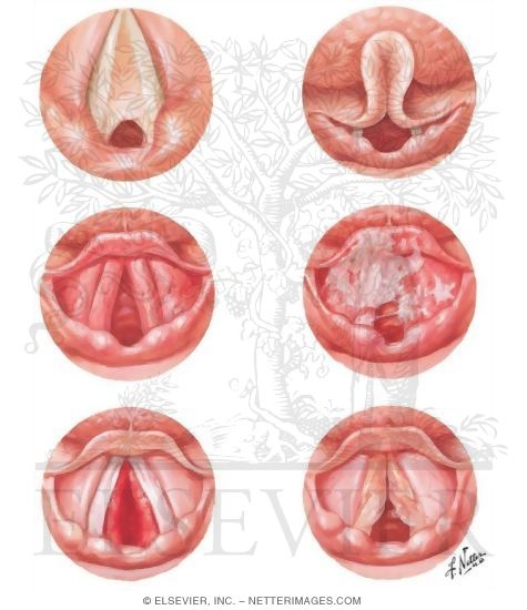 Watermarked preview of unlabeled image: Congenital and Inflammatory Disorders