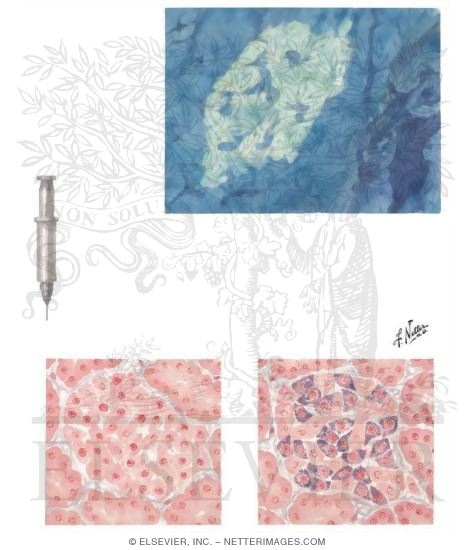 Watermarked preview of unlabeled image: Demonstration of Insulin in the Pancreatic Islets