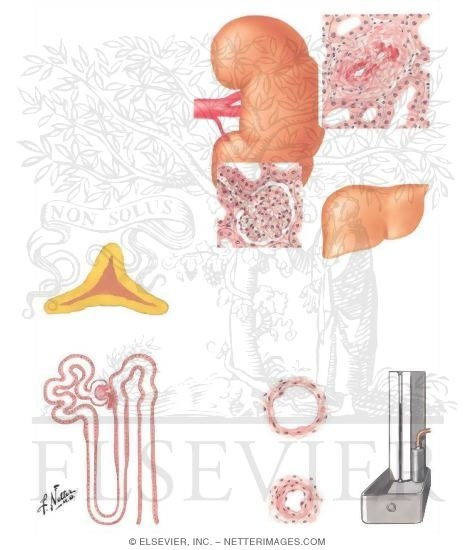 Watermarked preview of unlabeled image: Renin-Angiotensin-Aldosterone Relationships