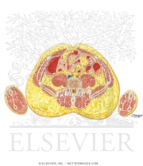 Watermarked preview of unlabeled image: Abdomen: Ileocecal Junction