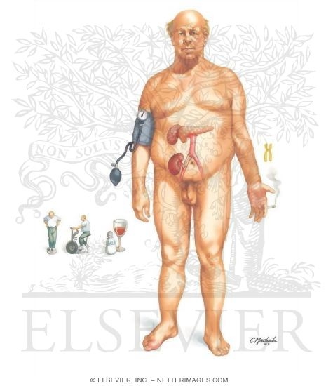 Watermarked preview of unlabeled image: Complications Common to All Transplantations