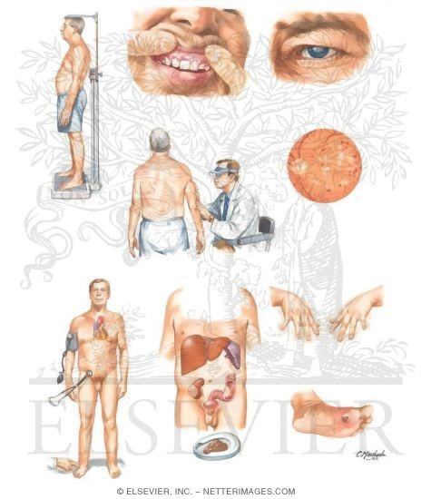 Watermarked preview of unlabeled image: Clinical Evaluation of Transplant Patient