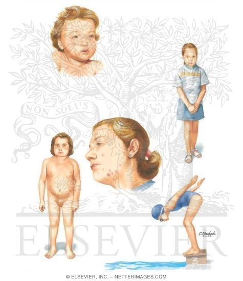 Watermarked preview of unlabeled image: Transplantation in Children