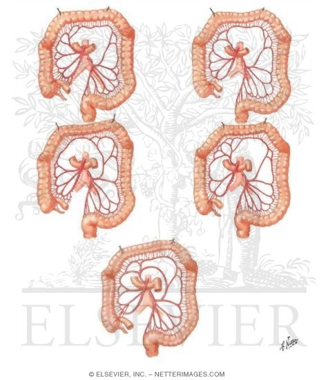 Watermarked preview of unlabeled image: Variations in Colic Arteries