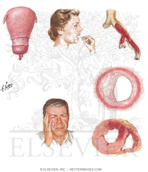 Watermarked preview of unlabeled image: Postmenopausal Hormone Changes and Therapy