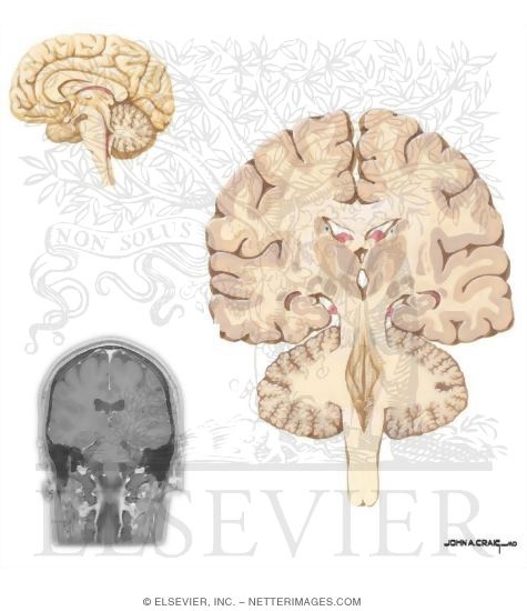 Coronal Sections Through the Forebrain: Midthalamus