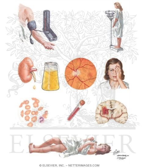 Preeclampsia / Eclampsia
