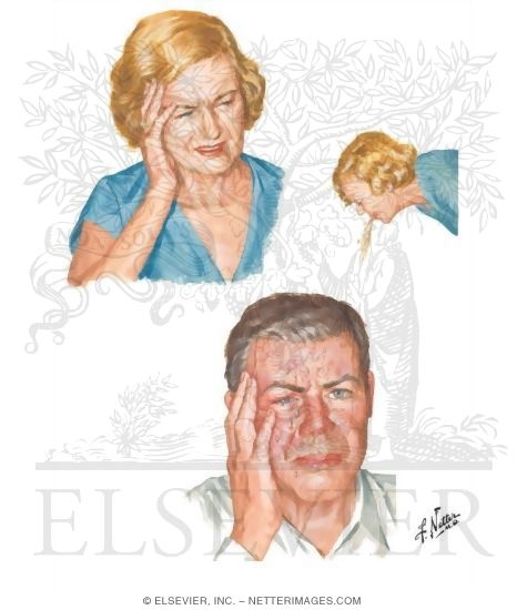 Watermarked preview of unlabeled image: Migraine Headaches