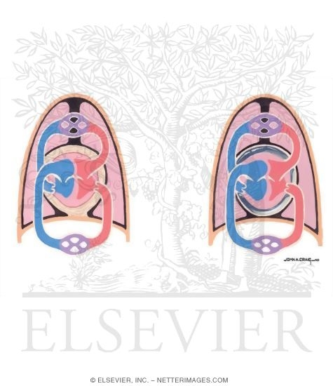 Watermarked preview of unlabeled image: Normal Cardiac Blood Flow During Inspiration and Expiration