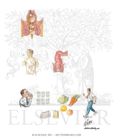 Watermarked preview of unlabeled image: Diagnosis and Management of Constipation