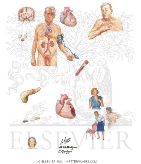 Watermarked preview of unlabeled image: Cardiovascular Disease in Women and the Elderly