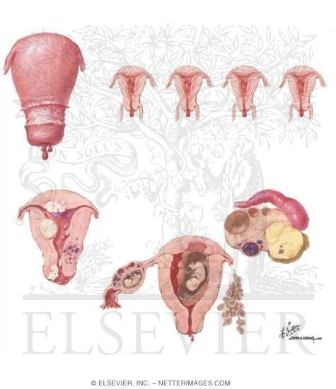 intermenstrual bleeding