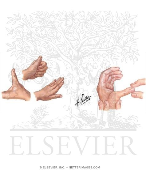 Watermarked preview of unlabeled image: Physical Examination of the Thumb