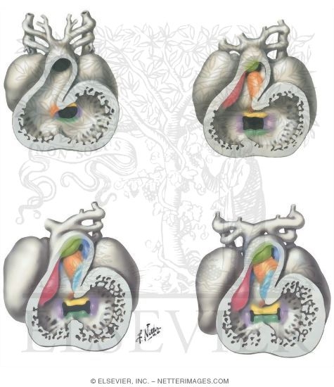 Spiral (Aorticopulmonary) Septum