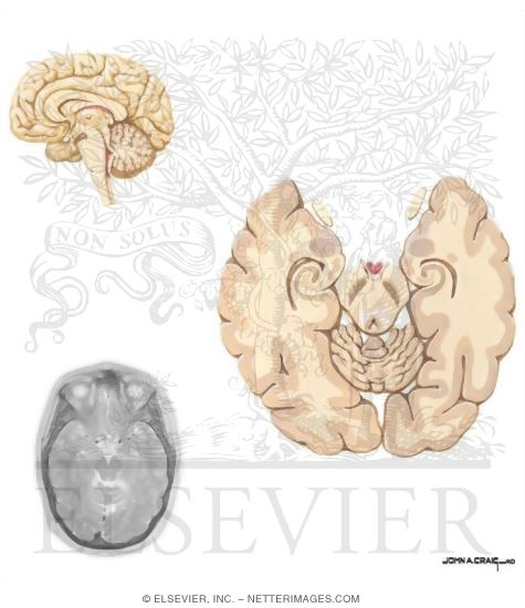 Horizontal Sections Through the Forebrain: Midbrain