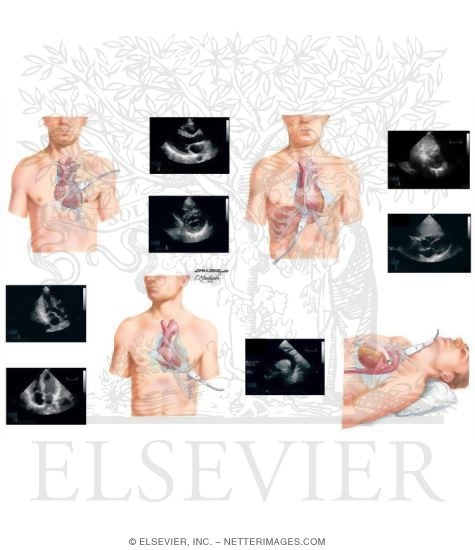 Transducer Positions in Echocardiographic Examination