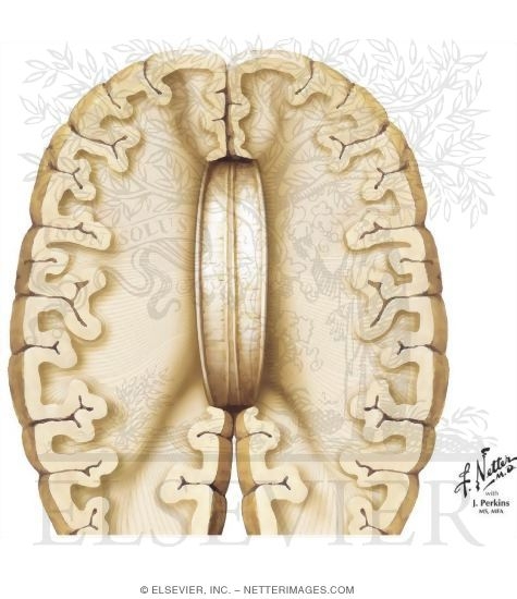 Corpus Callosum: Schematic View of the Lateral Extent of Major Components