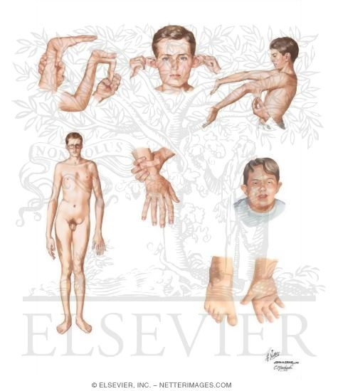 Physical Examination: General Inspection