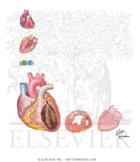 Watermarked preview of unlabeled image: Sudden Cardiac Death