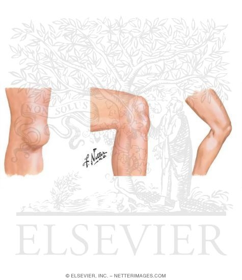 Watermarked preview of unlabeled image: Physical Exam of the Leg and Knee