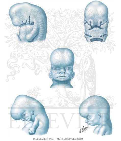 Development of the Face: 6 to 10 Weeks